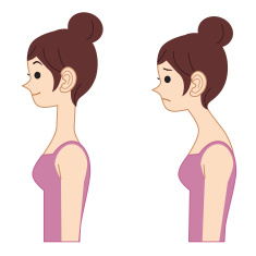 stock-illustration-28583708-bad-posture-in-women